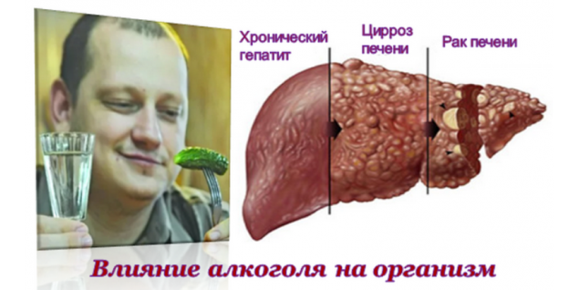Последствия алкоголизма